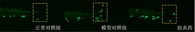 斑马鱼尾鳍炎症中性粒细胞表型图